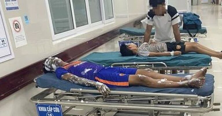 Tự chế pháo nổ dẫn đến phát nổ, 4 học sinh nhập viện