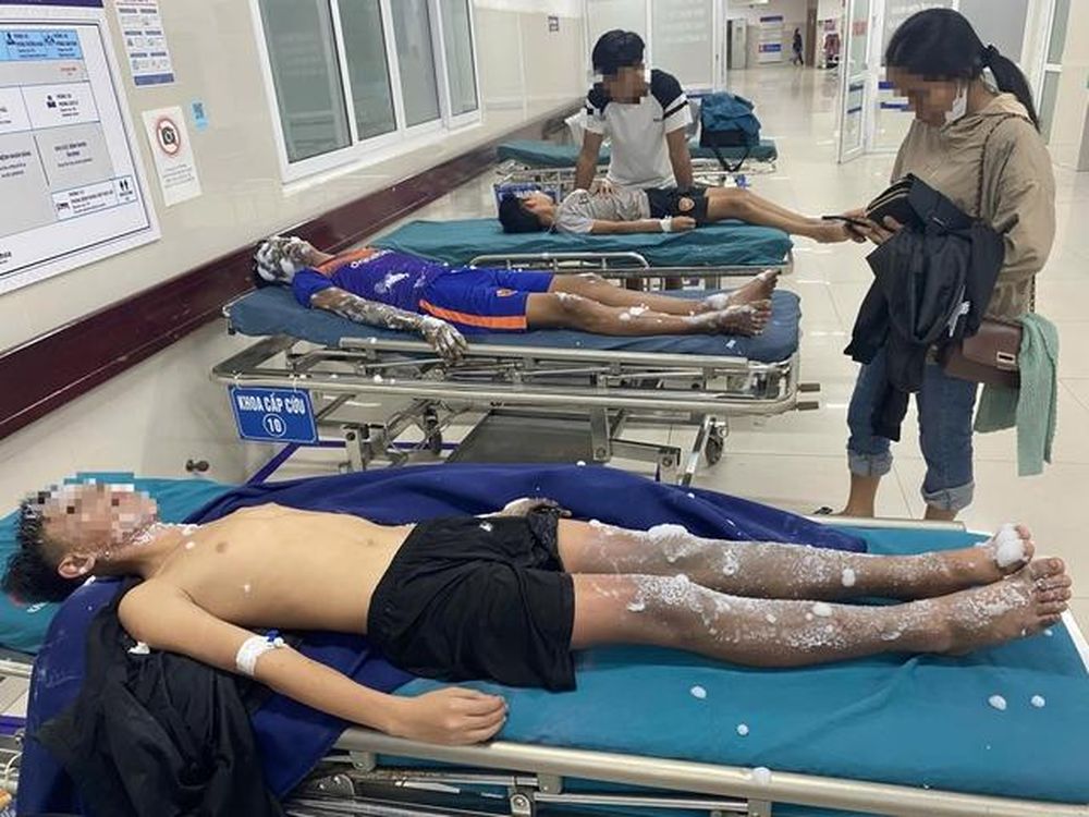 Quảng Bình: Tự chế pháo nổ dẫn đến phát nổ, 4 học sinh nhập viện- Ảnh 1. Quảng Bình: Tự chế pháo nổ dẫn đến phát nổ, 4 học sinh nhập viện- Ảnh 1.